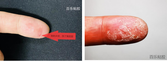 502膠水把手黏住了干了怎么辦